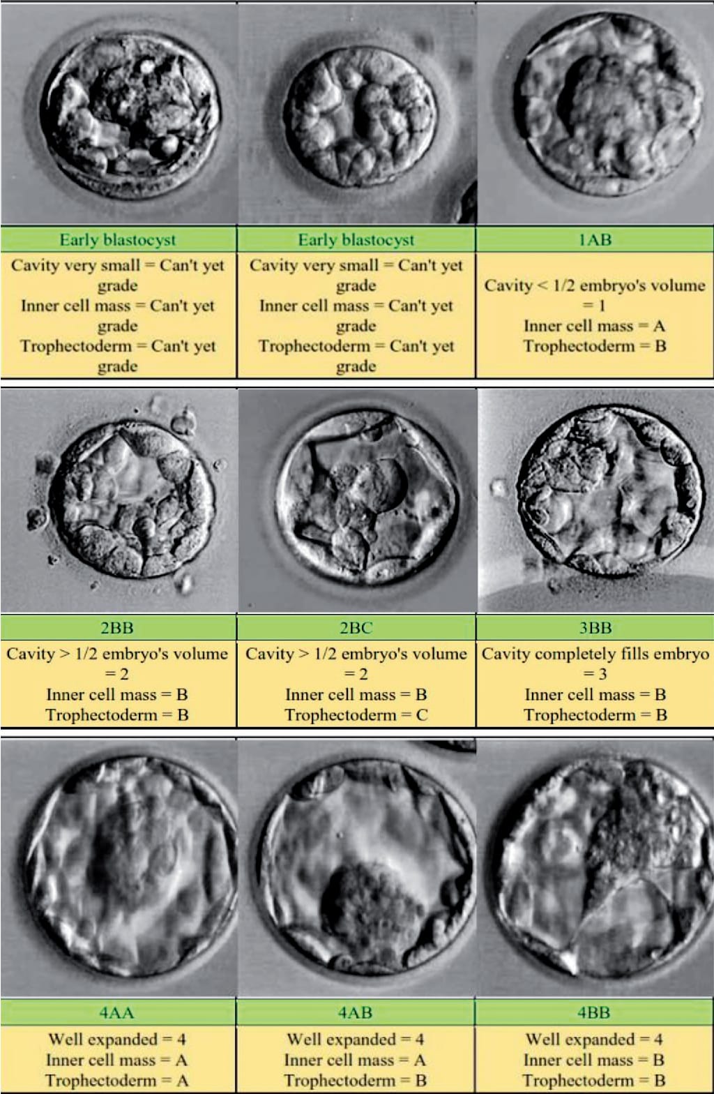 Blastocyst transfer procedure in IVF at GHRACE & HOPE IVF showing advanced embryo transfer for improved pregnancy outcomes.