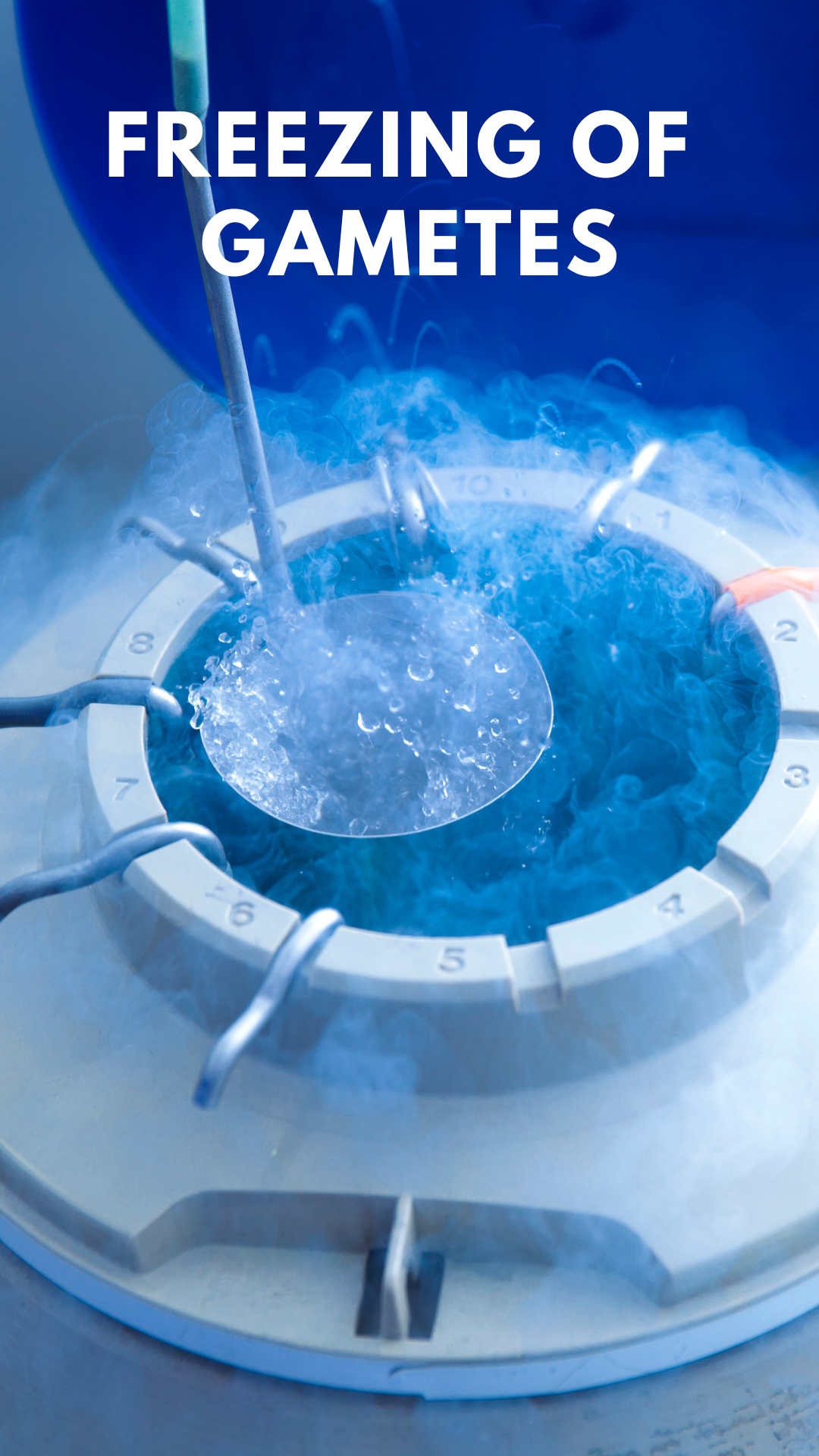 Egg and sperm freezing services at Ghrace & Hope IVF Centre for fertility preservation and future family planning.