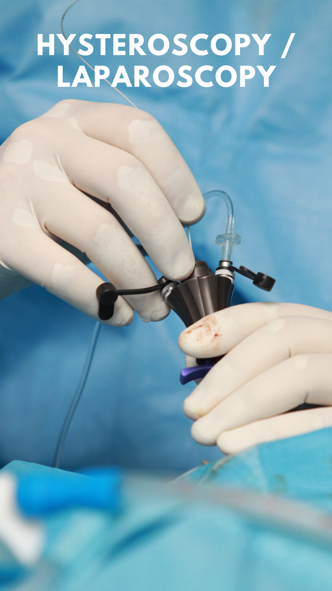Hysteroscopy and laparoscopy procedures for fertility diagnosis and treatment at Ghrace & Hope IVF Centre Delhi.